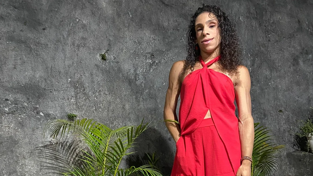 Doença rara faz mulher ter ausência quase total de gordura aparente