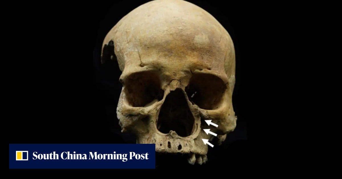 Cientistas chineses encontram as primeiras evidências da antiga punição de corte do nariz para ladrões de gado