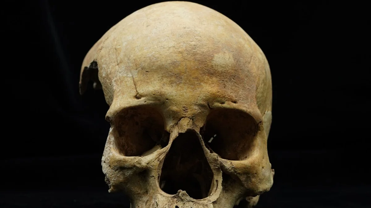 Mulher enterrada de bruços teve nariz amputado há cerca de 700 anos