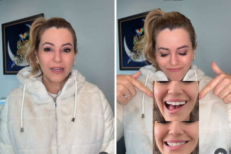 Ex-Panicat Tania Oliveira revela intercorrência em retirada de tumor: 'Meu sorriso ficou comprometido'