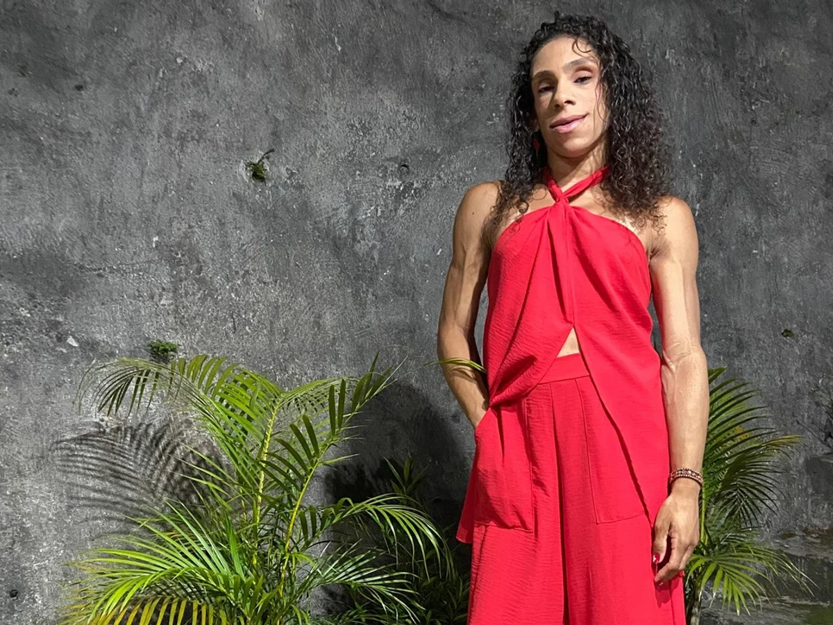 Doença rara faz mulher ter ausência quase total de gordura aparente