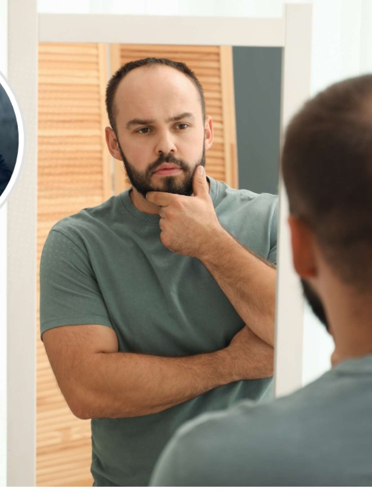 A calvície não começa quando o cabelo cai. Ela começa quando você muda seus hábitos