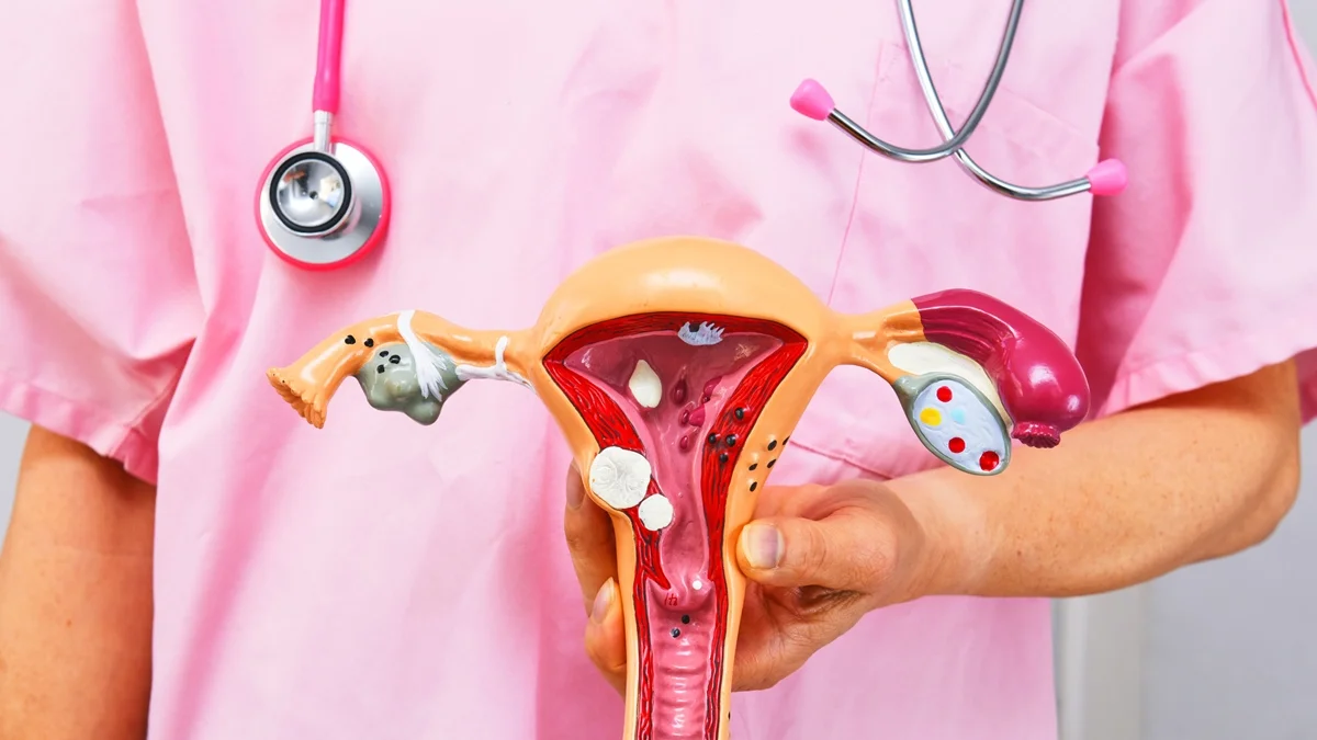 Planos de saúde passam a cobrir DIU hormonal para pessoas com endometriose