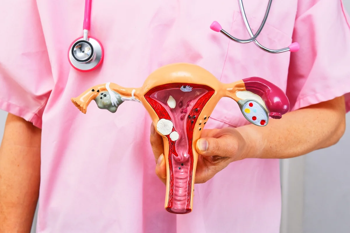 Planos de saúde passam a cobrir DIU hormonal para pessoas com endometriose