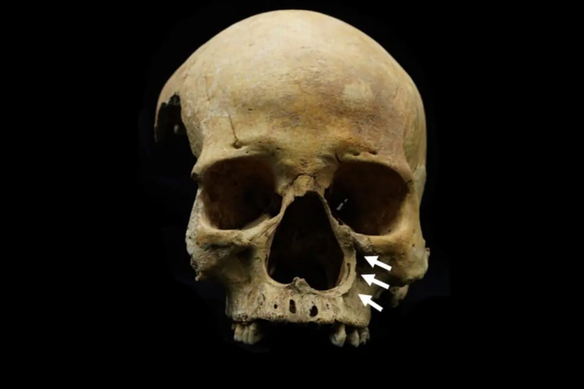 Cientistas chineses encontram as primeiras evidências da antiga punição de corte do nariz para ladrões de gado