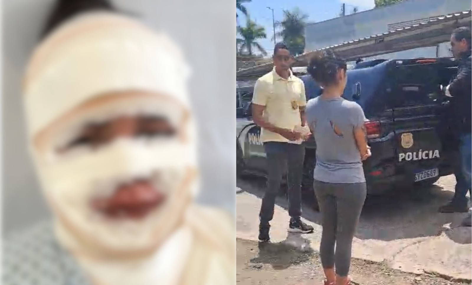 Vítima ficou com o rosto queimado; autora foi presa pela PC Reprodução/PCMG