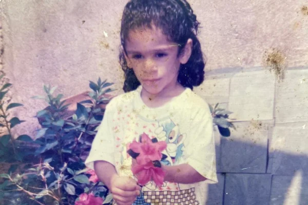 Doença rara faz mulher ter ausência quase total de gordura aparente