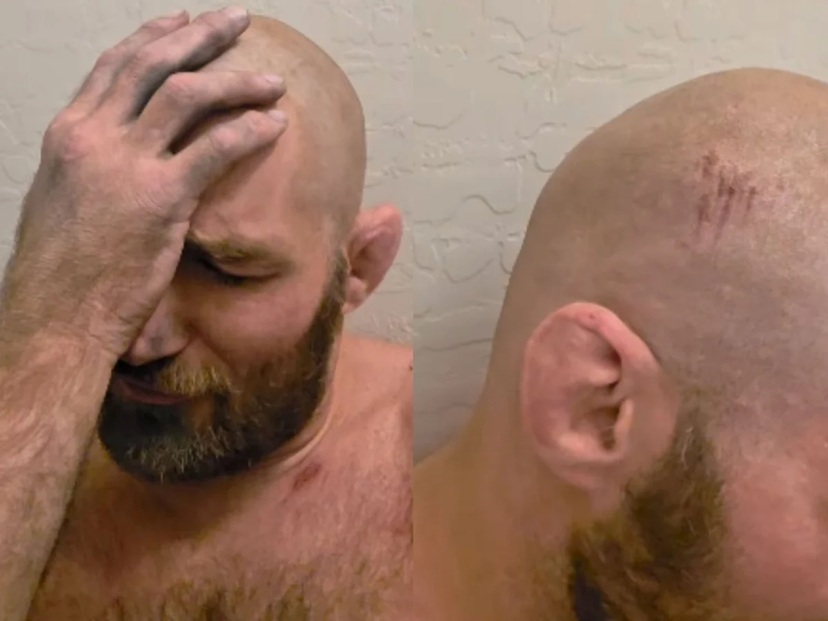Campeão do UFC, Strickland é vítima de capotamento de carro e tem concussão
