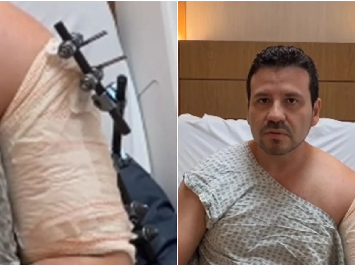 Médico em carro blindado cai em golpe do retrovisor e acaba baleado no Rio