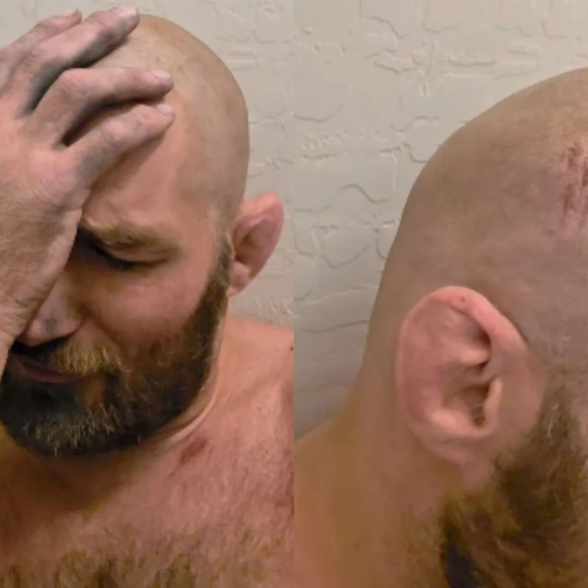 Campeão do UFC, Strickland é vítima de capotamento de carro e tem concussão