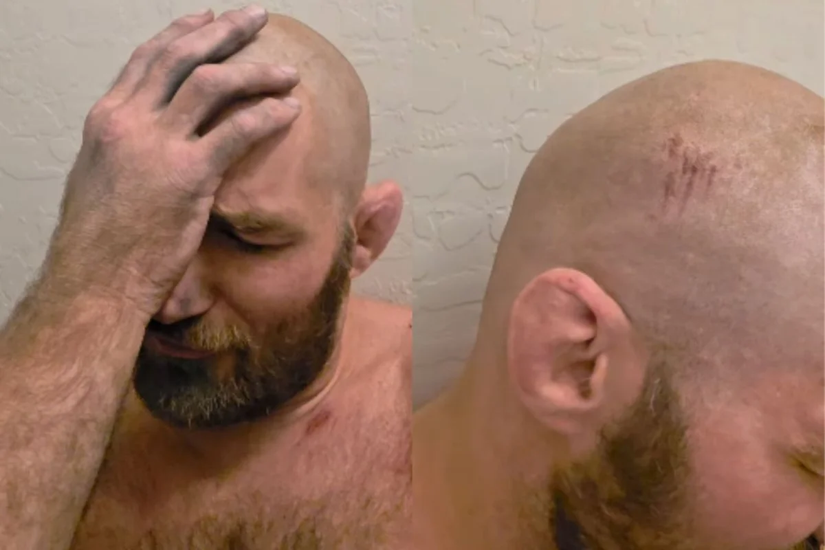 Campeão do UFC, Strickland é vítima de capotamento de carro e tem concussão