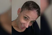 Ana Carolina não tinha histórico familiar de câncer de mama antes de receber o diagnóstico aos 38 anos