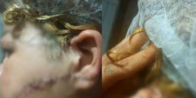 Suspeito teria desfigurado rosto da ex-esposa ao golpeá-la com uma faca Foto: Reprodução/TV Anhanguera