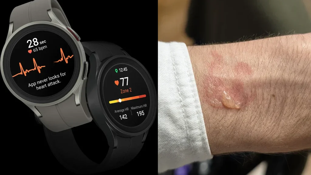 Usuários relatam queimaduras e irritação na pele após usar Galaxy Watch durante a noite